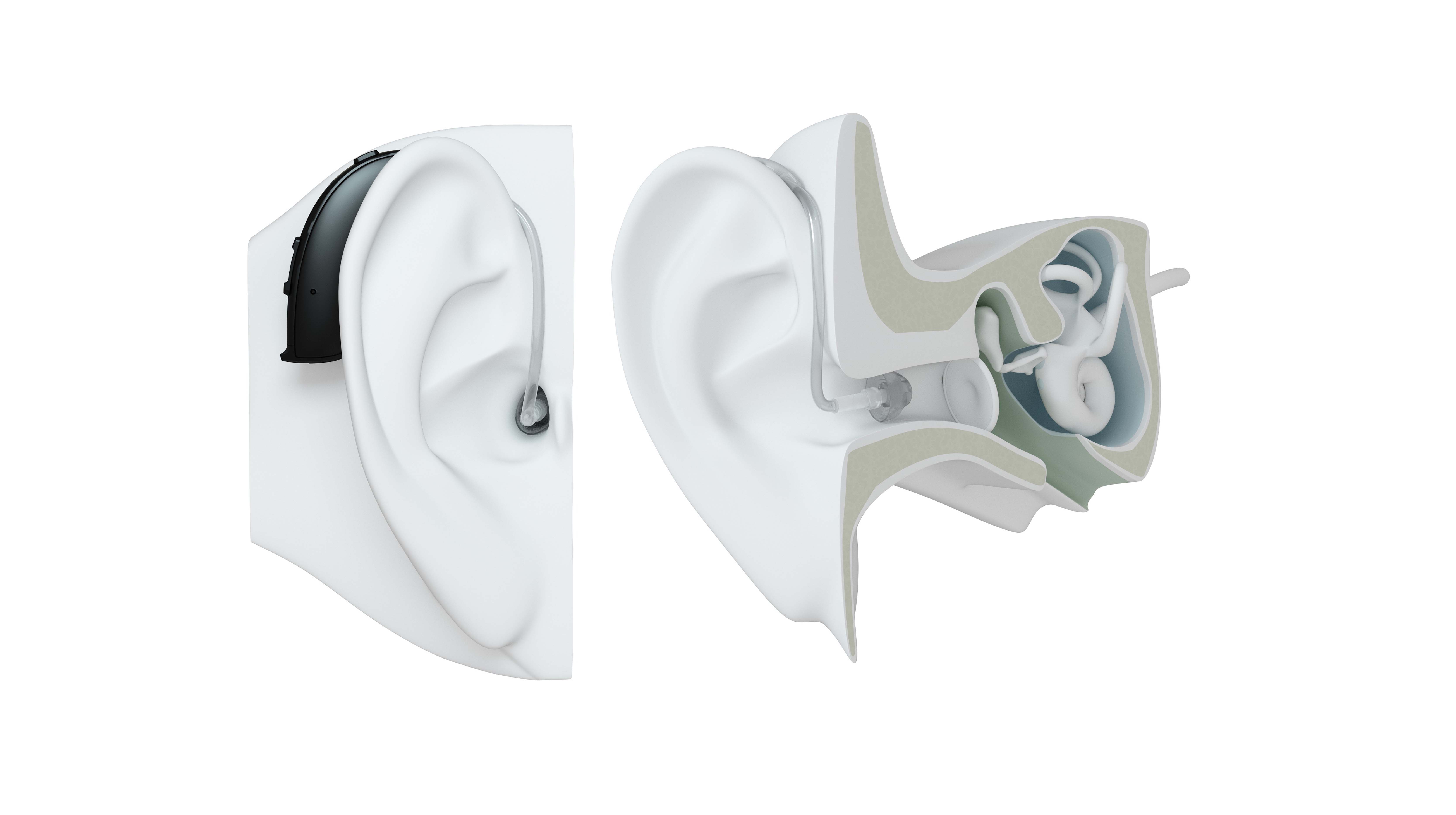Behind-the-Ear hearing aids | ReSound