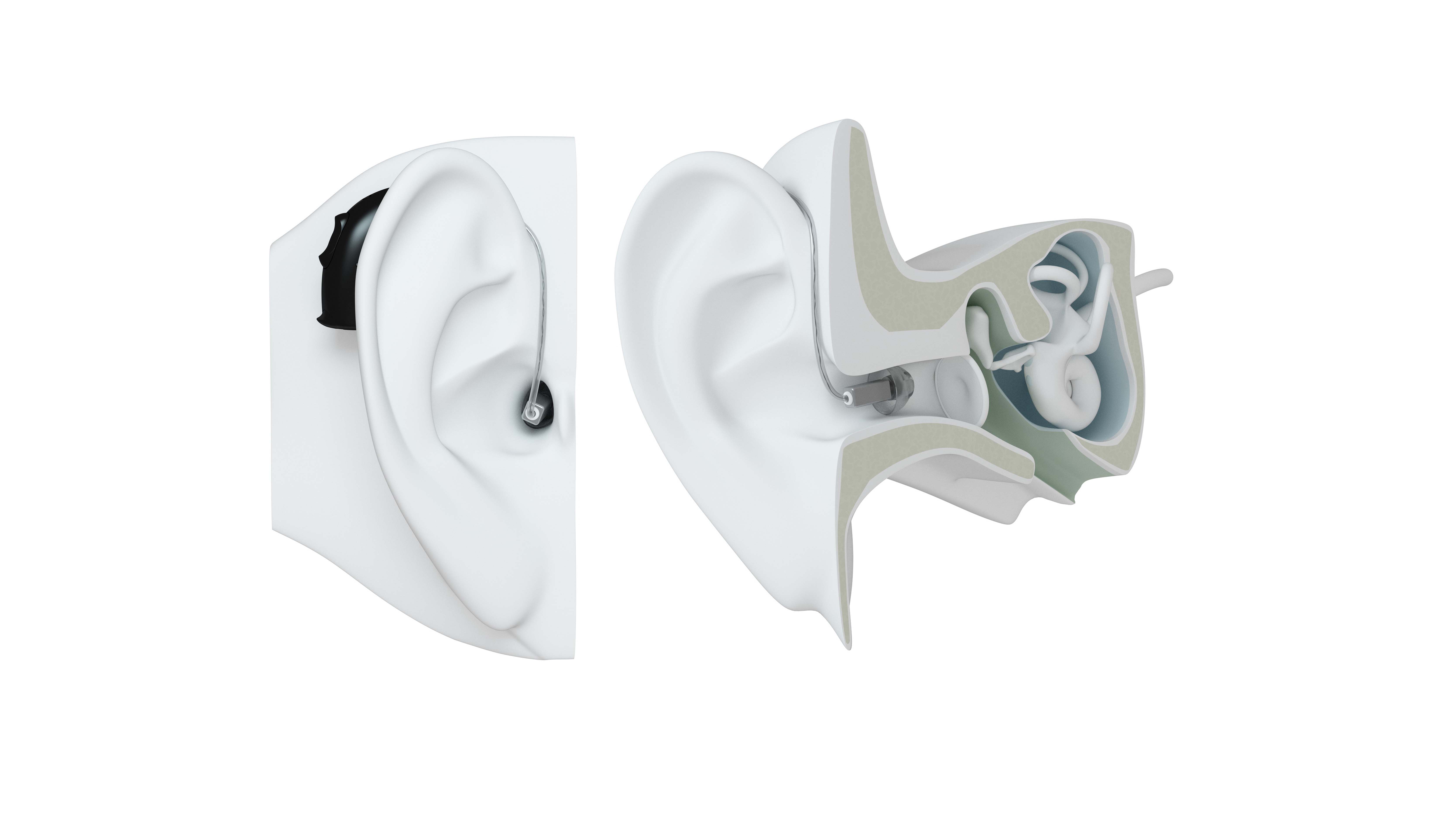 RIE hearing aid on ear.